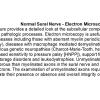 0A Normal Electron Microscopy - Text
