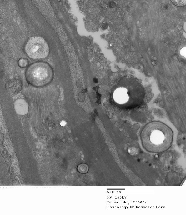 10A2 (Case 10) 007 - Copy