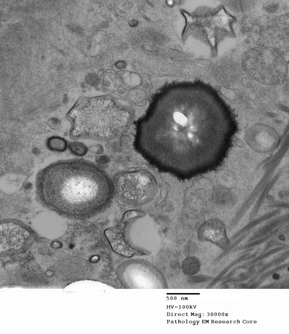 10A4 (Case 10) 017 - Copy