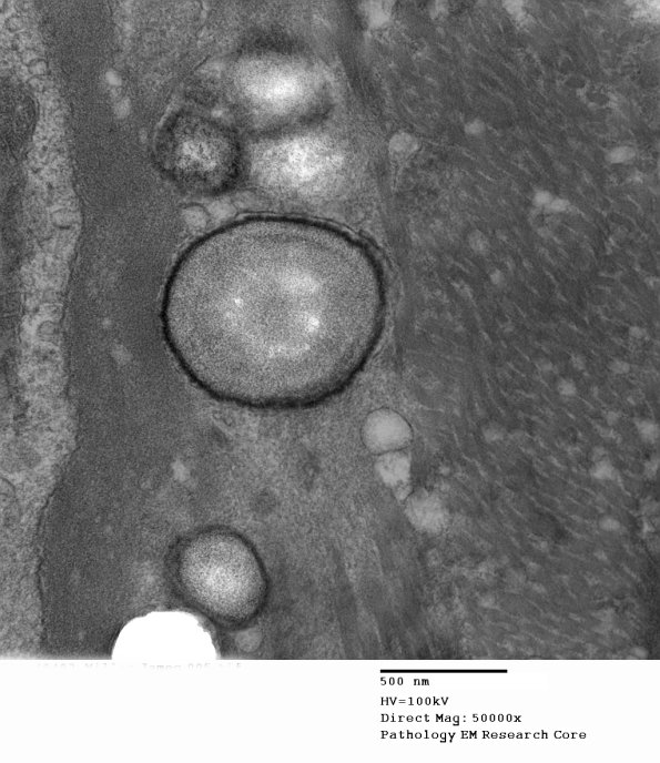 10A5 (Case 10) 005 - Copy