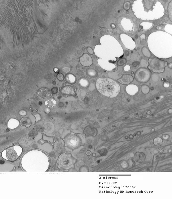 10A6 (Case 10) 015 - Copy