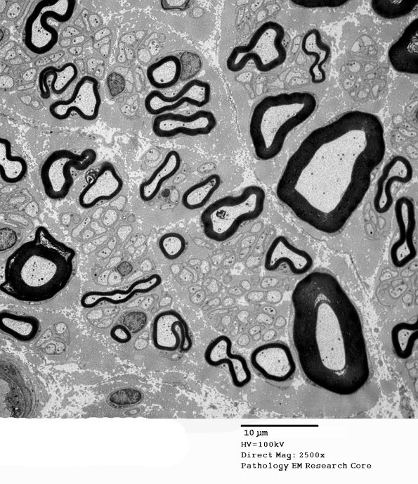 1A3 Normal Nerve (Case 1) new_004A - Copy