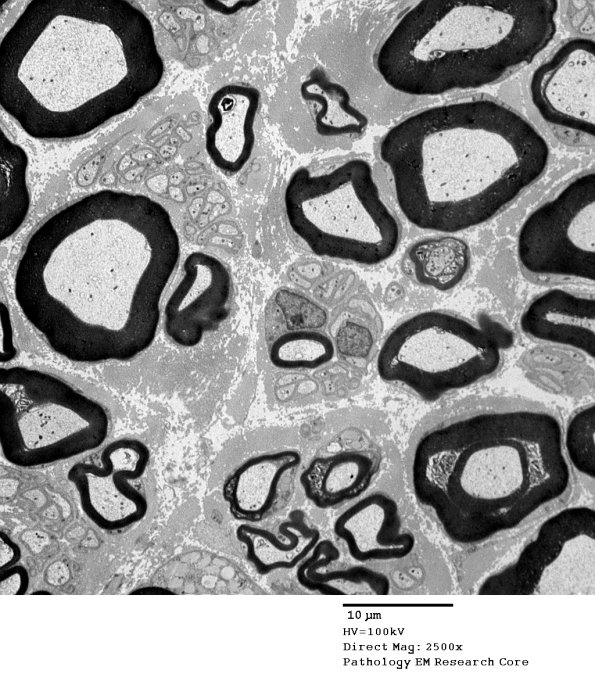 1A5 Normal Nerve (Case 1) new_010A - Copy