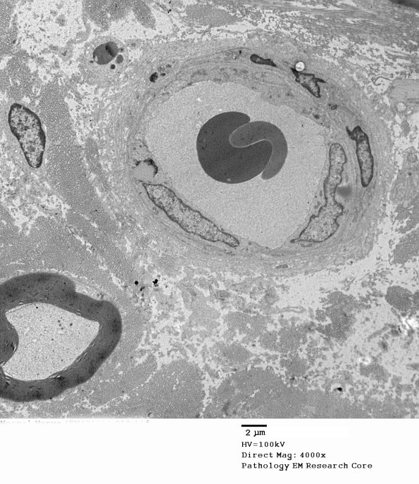 1A8 Normal Nerve (Case 1)_010 - Copy