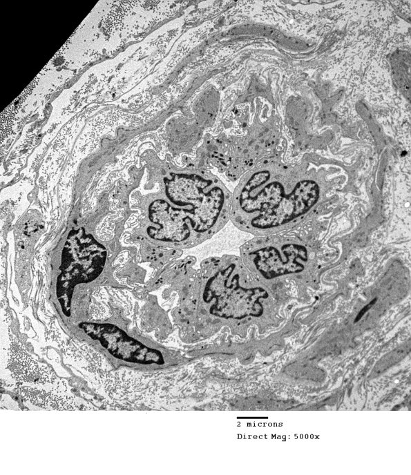 2A1 Normal venule  (Case 2) EM 002 - Copy