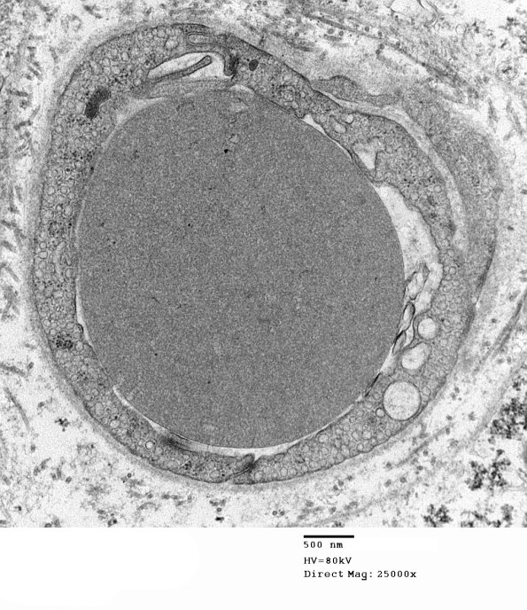 3A1 Normal Sural nerve, 3 mo age (Case 3) 015 - Copy