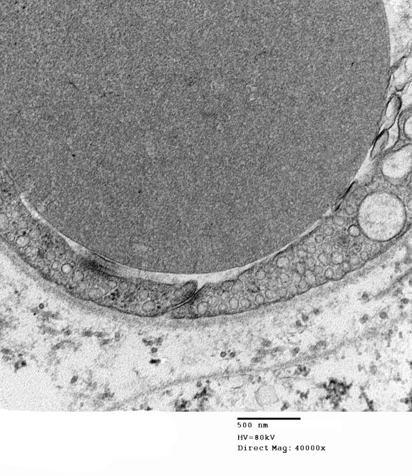 3A2 Normal Sural nerve, 3 mo age (Case 3) 014 - Copy