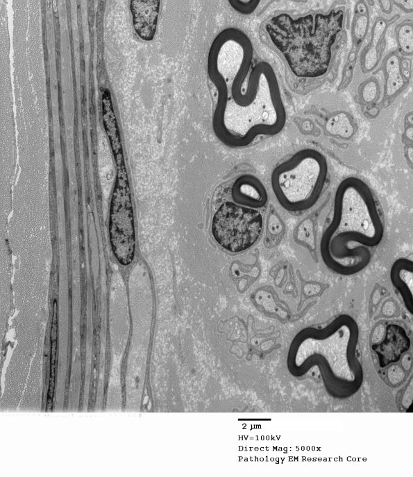 4A1 (Case 4) Normal nerve_012 - Copy