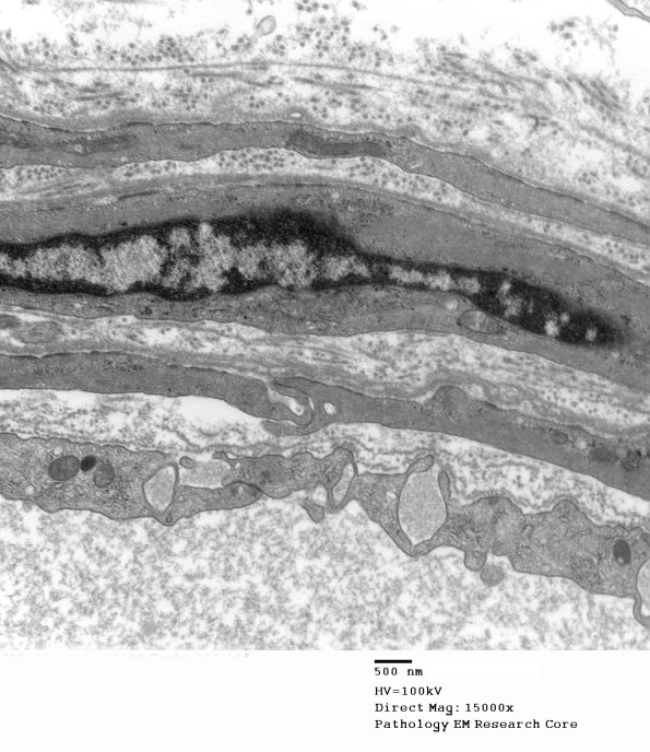 5A1 (Case 5) 003 - Copy