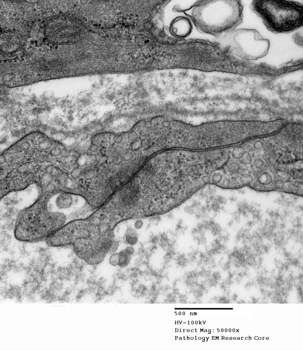5A3 (Case 5) 005 - Copy