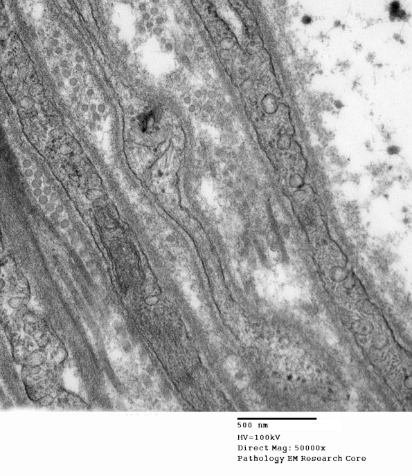 5A5 (Case 5) 013 - Copy