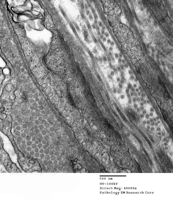 5A6 (Case 5) 012 - Copy