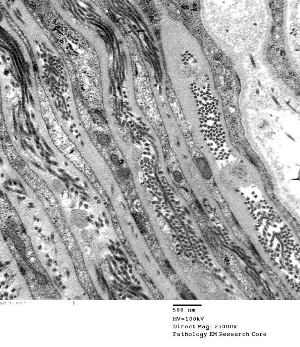 7A1 (Case 7) 004 - Copy
