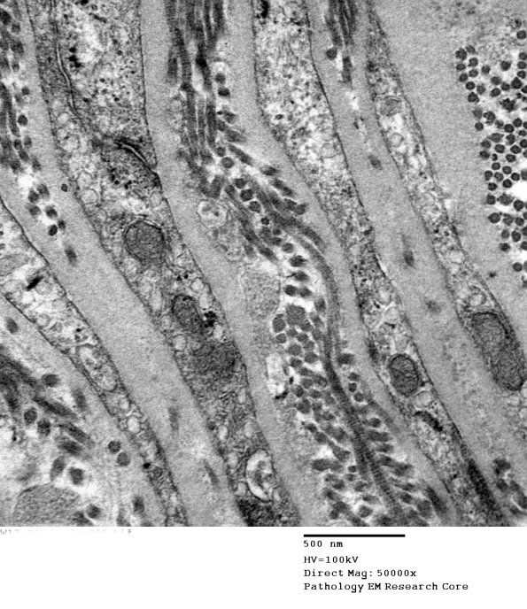 7A2 (Case 7) 005 - Copy A - Copy