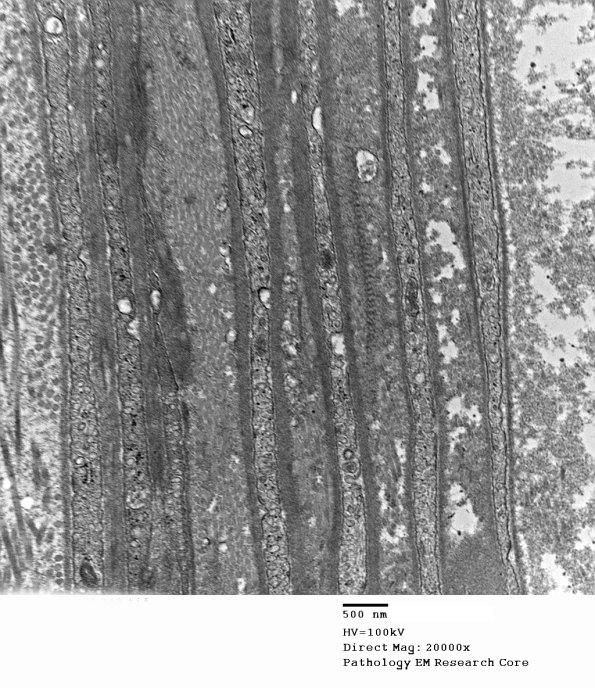 8A1 (Case 8) 043 - Copy