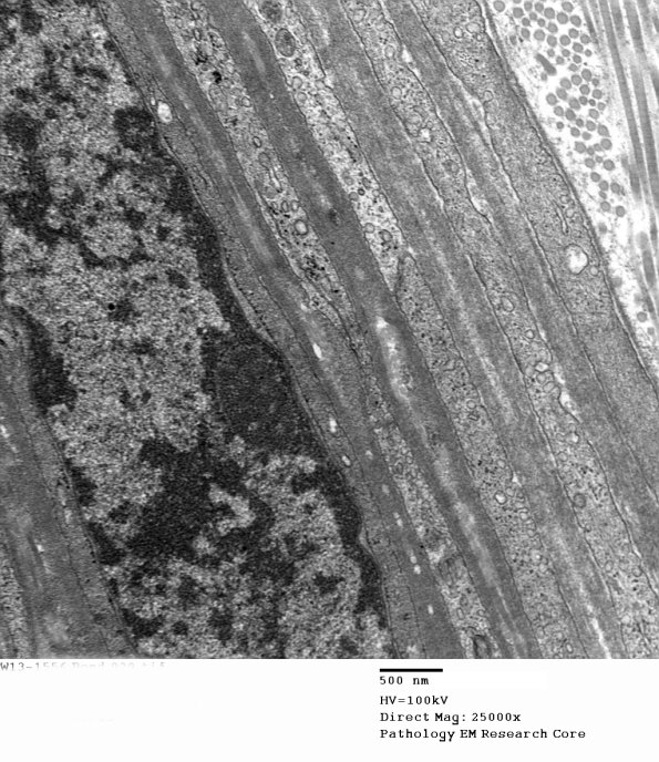 8A2 (Case 8) 029 - Copy