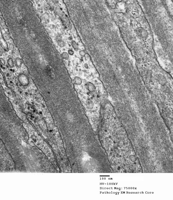 8A3 (Case 8) 031 - Copy