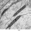 1A1 Fibroblasts (Case 1) EM 002 - Copy