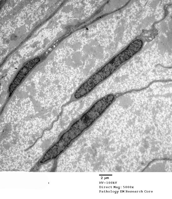 1A1 Fibroblasts (Case 1) EM 002 - Copy
