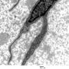 1A2 Fibroblasts (Case 1) EM 003 - Copy