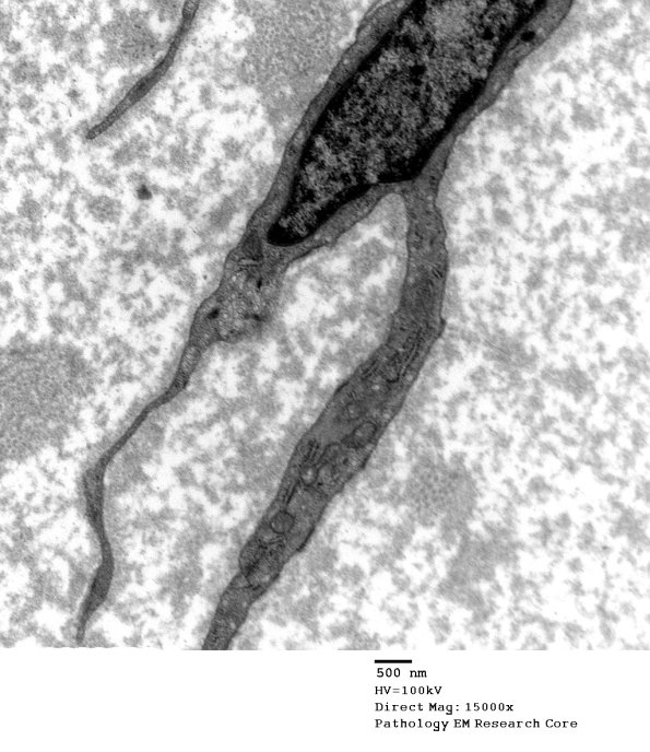 1A2 Fibroblasts (Case 1) EM 003 - Copy