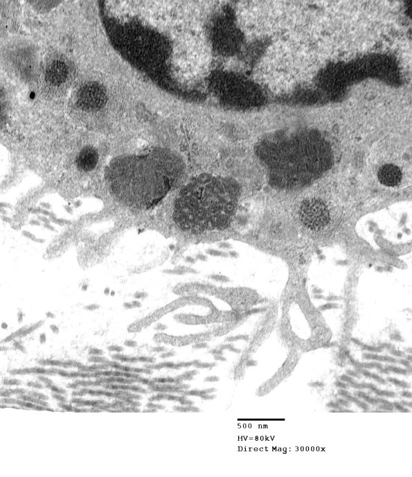 2A2 Mast Cell (Case 2) EM_006 - Copy