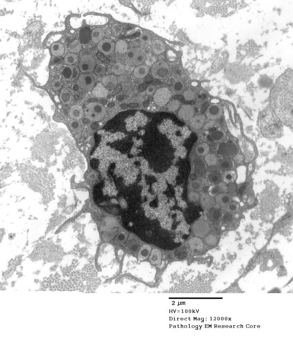 3A1 Mast Cell (Case 3) 030 - Copy
