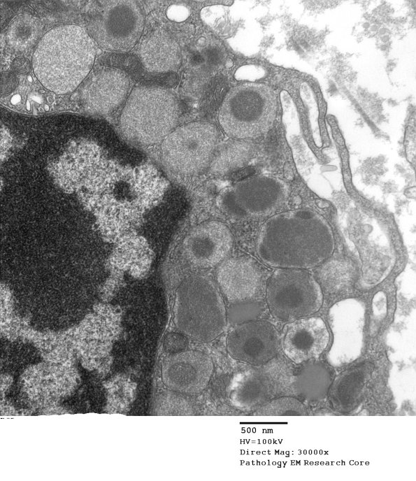 3A2 Mast Cell Case 3) 031 - Copy