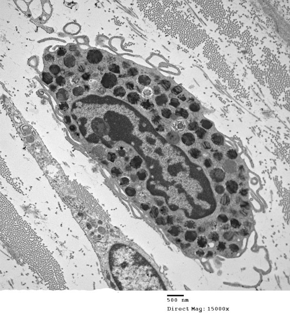 4A1 Mast Cell, nerve (Case 4)  EM 19 - Copy