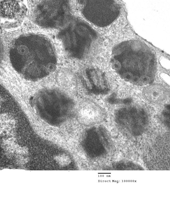 4A4 Mast Cell, nerve (Case 4)  EM 23 - Copy