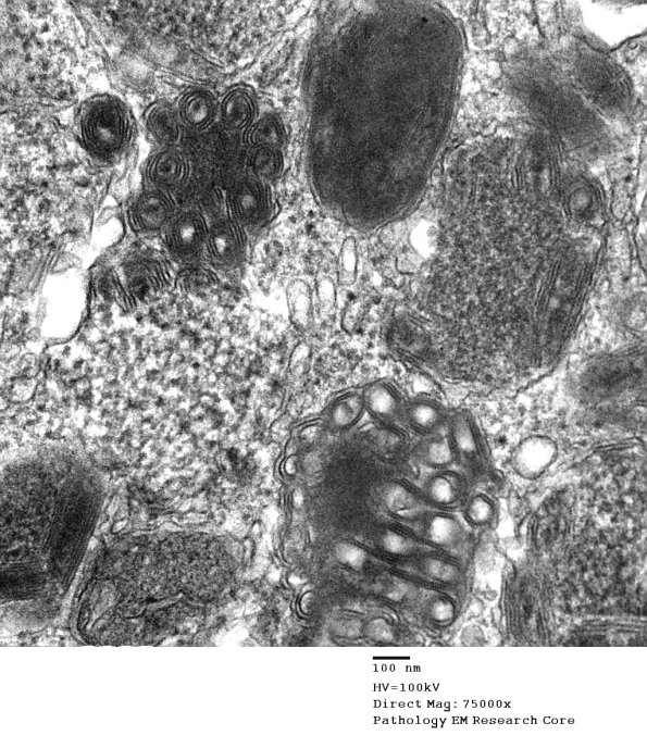 5A3 Mast cell, scrolls (Case 5) 010 - Copy