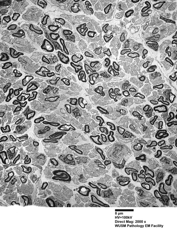 1B2 (Case 1) EM 012 - Copy