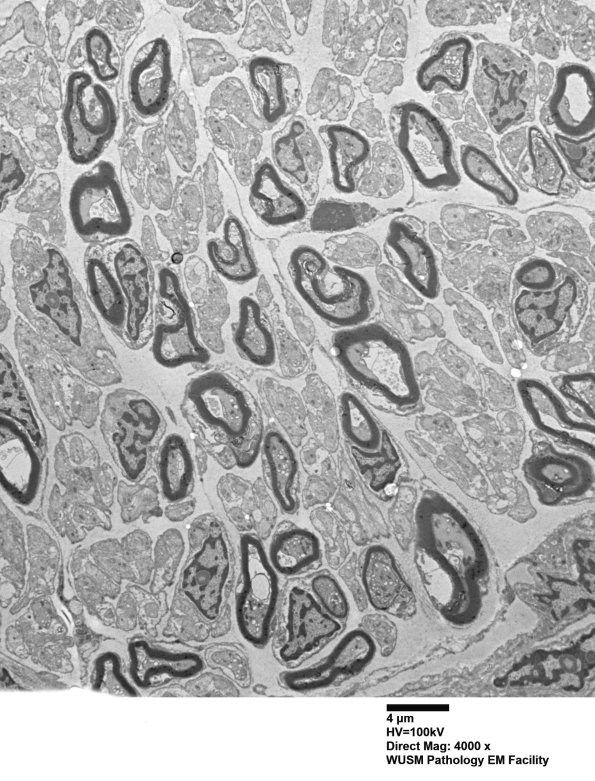 1B3 (Case 1) EM 003 - Copy