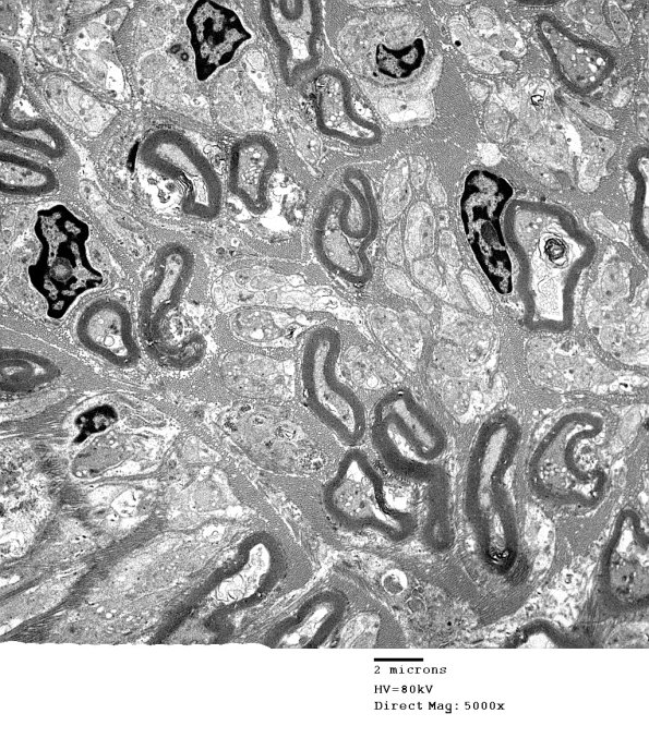 1B4 (Case 1) EM 002 - Copy