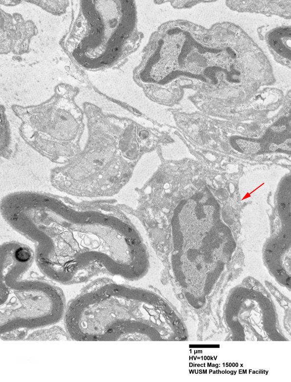 1B6 (Case 1) EM 016 - Copy copy