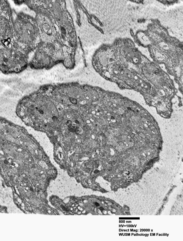 1B8 (Case 1) EM 005 - Copy