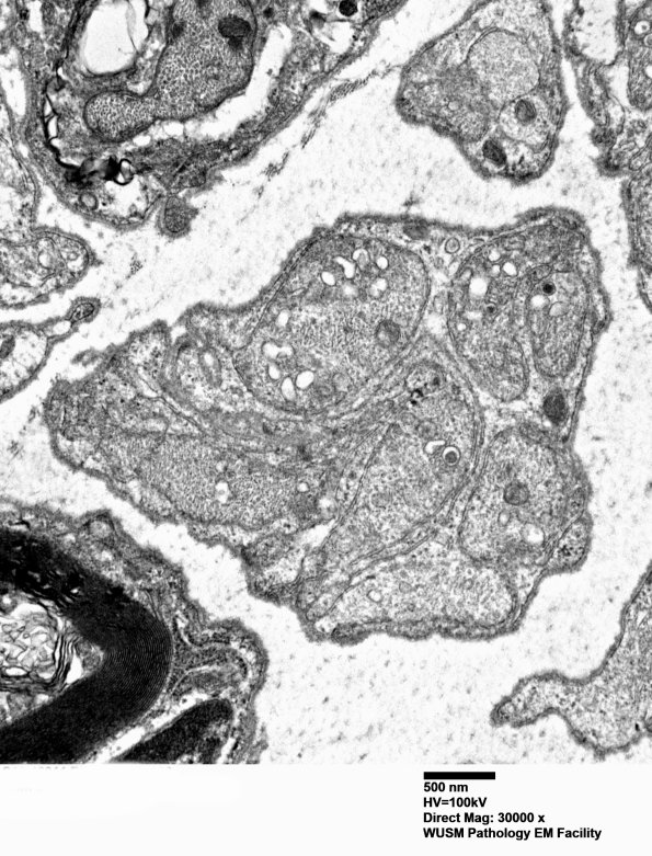 1B9 (Case 1) Blk2 EM 030 - Copy