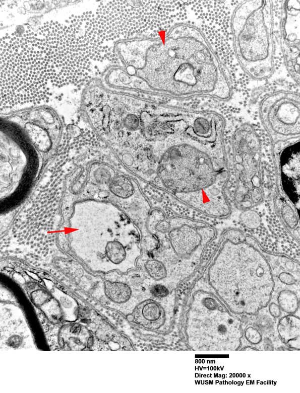 3B2 (Case 3) 023 - Copy copy