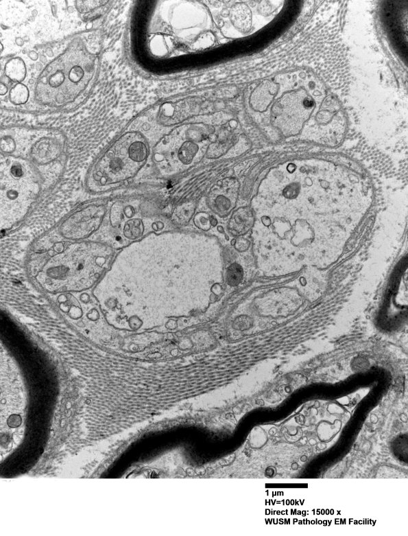 3B3 (Case 3) 015 - Copy