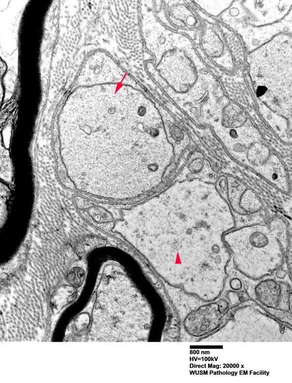 3B4 (Case 3) 040 - Copy copy