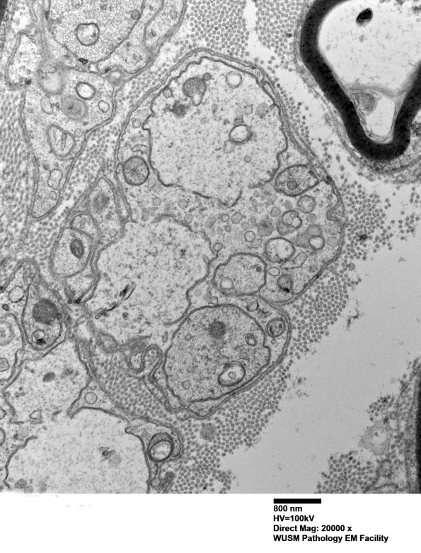 3B5 (Case 3) 038 - Copy