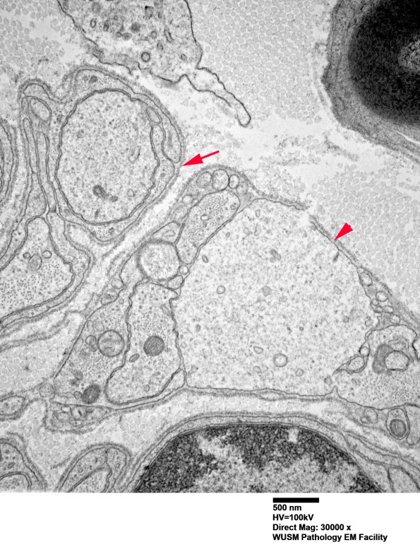 6B10 (Case 6) EM 015 - Copy copy