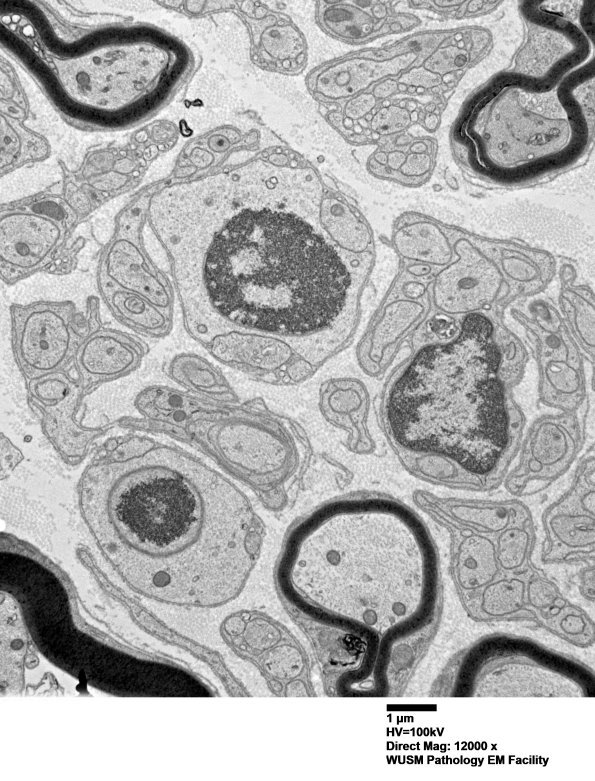 6B11 (Case 6) EM 027 - Copy