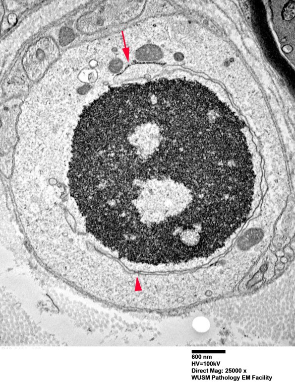 6B12 (Case 6) EM 029a - Copy copy