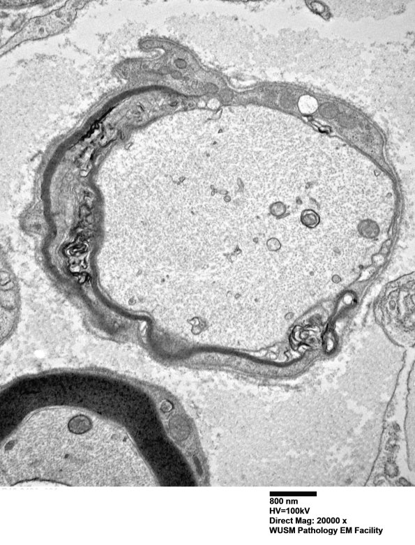 6B13 (Case 6) EM 031 - Copy