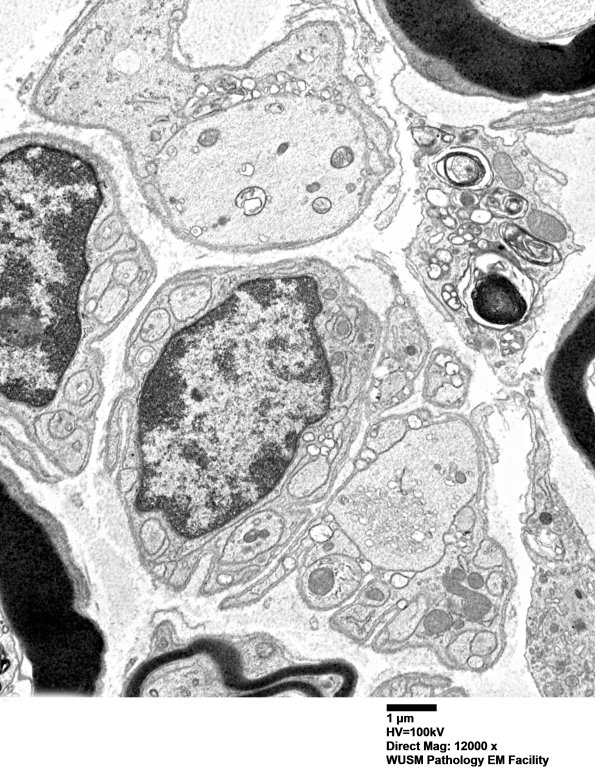 6B14 (Case 6) EM 034 - Copy - Copy