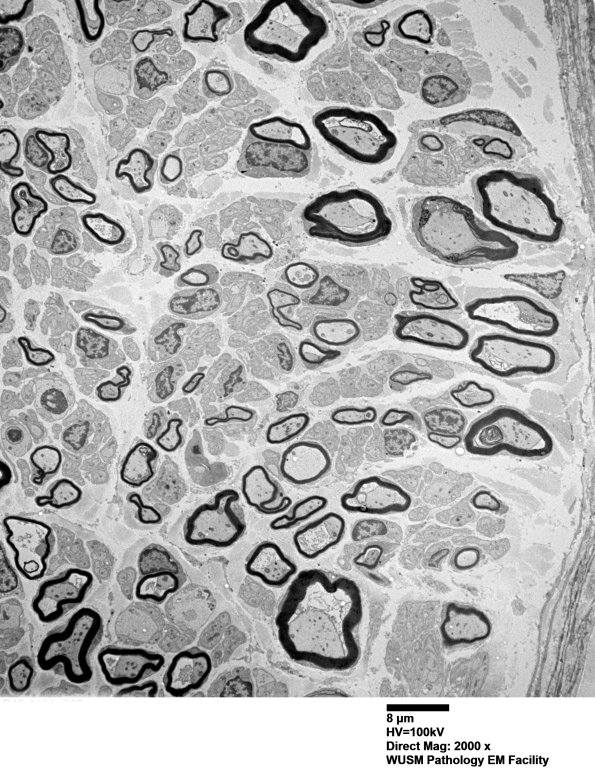 6B2 (Case 6) EM 002 - Copy