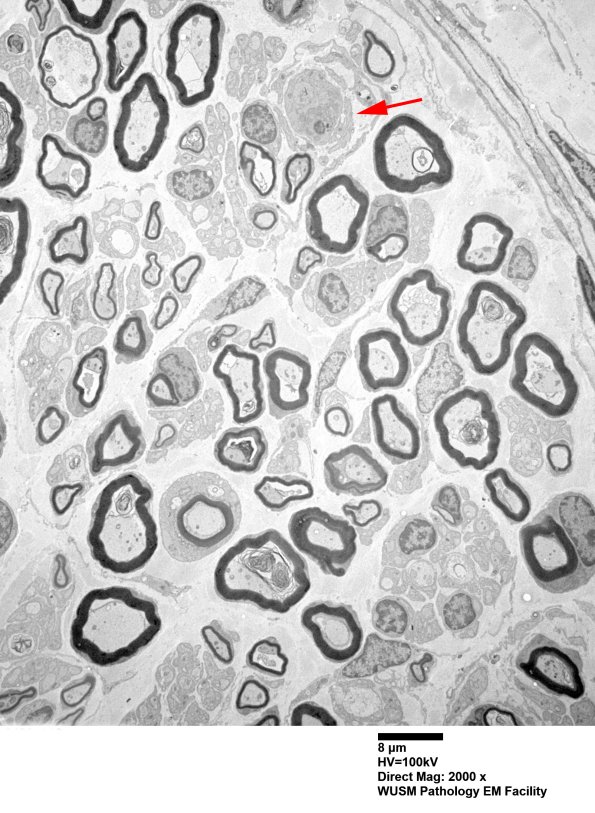 6B3 (Case 6) EM 006 - Copy copy