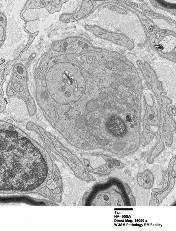 6B4 (Case 6) EM 009 - Copy