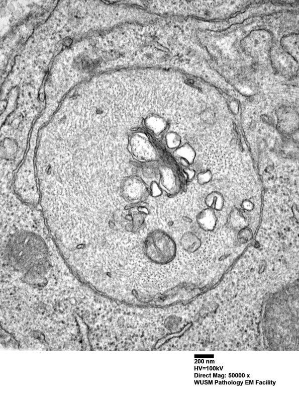 6B5 (Case 6) EM 011 - Copy (2)